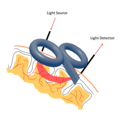 TMS equipment?Combined with fNIRS